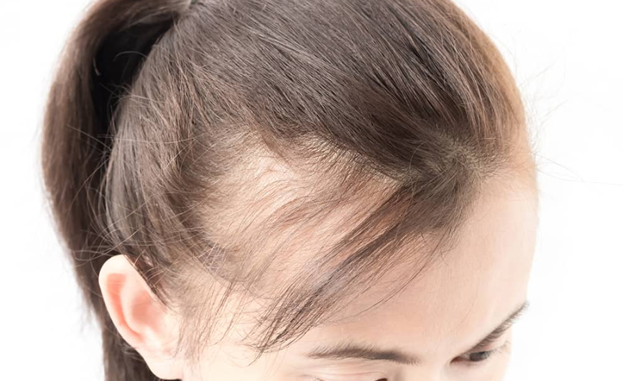 Are There Natural Remedies For Hair Care?